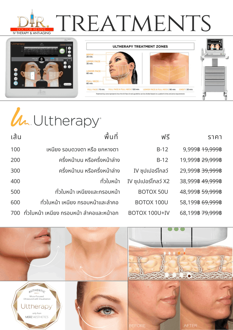 Ultherapy